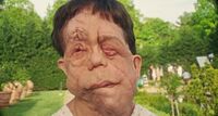 Still uit de film Chained for life. Portret van Rosenthal, die neurofibromatose heeft waardoor zijn gezicht misvormd is