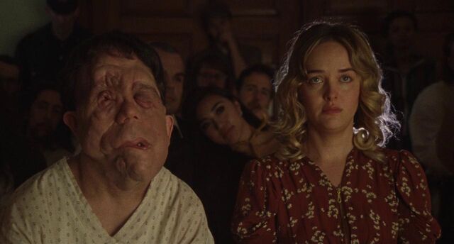Still uit de film Chained for Life. Rosenthal en Mabel zitten samen in een donkere zaal met publiek achter hen. Rosenthal heeft door neurofibromatose een misvormd gezicht. Mabel is een knappe blonde vrouw en kijkt bedenkelijk